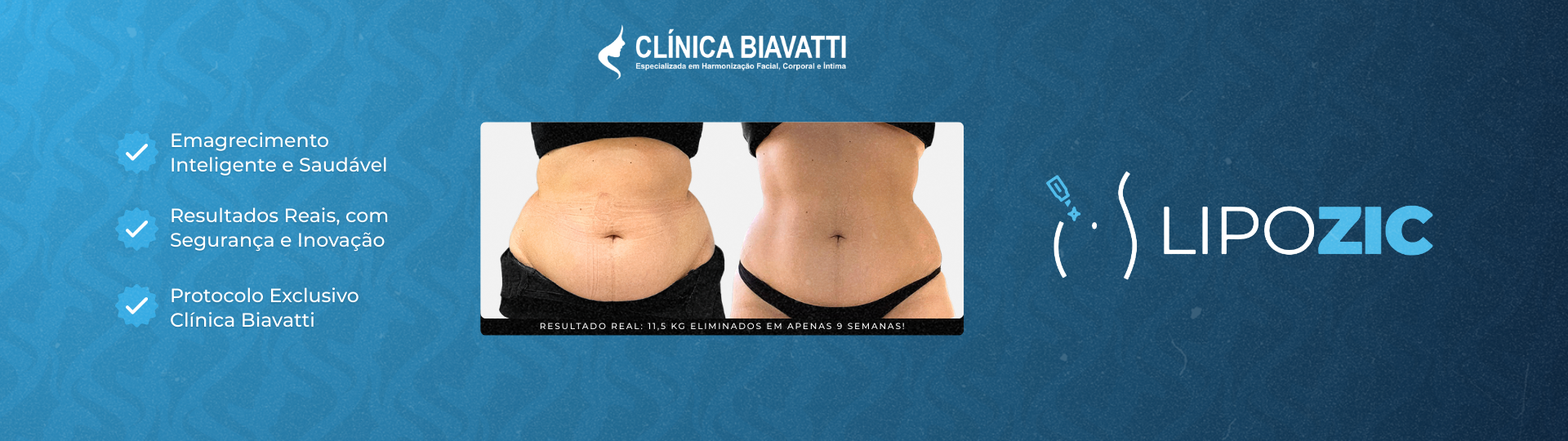 Lipozic Novo