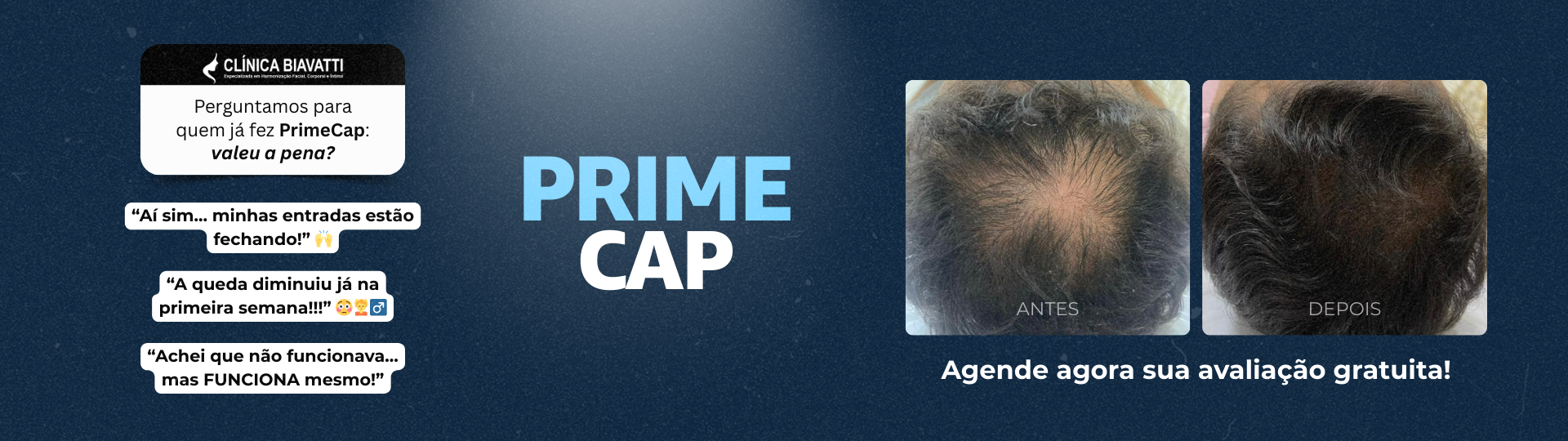 Prime Cap - Novo