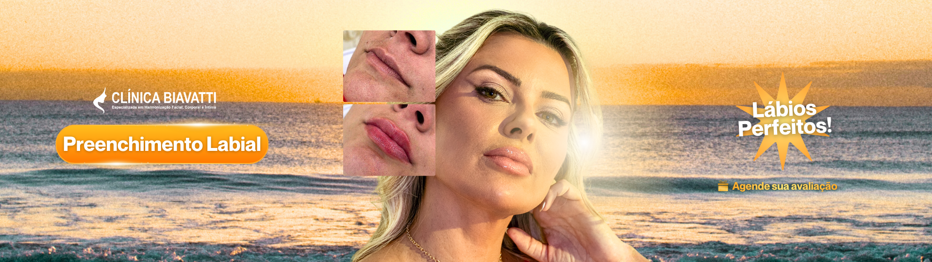 Preenchimento Labial