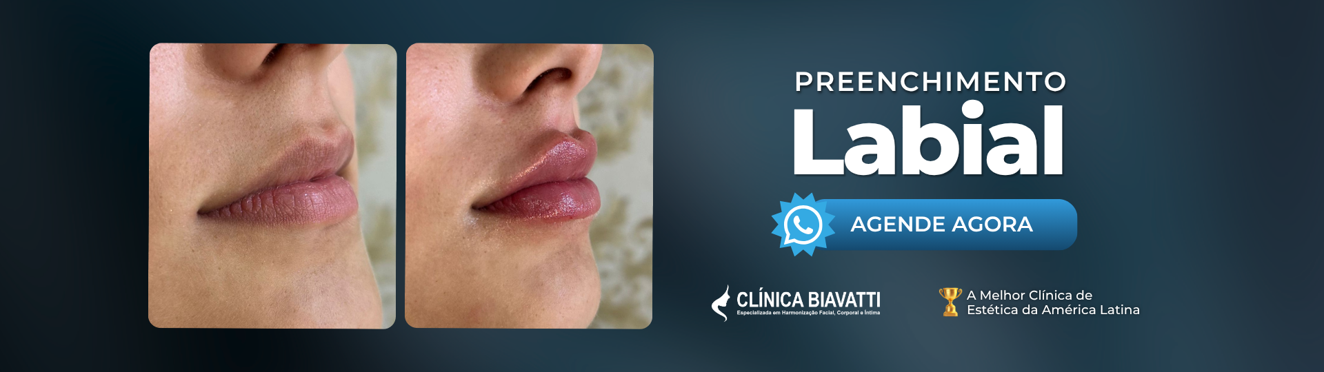 Labial