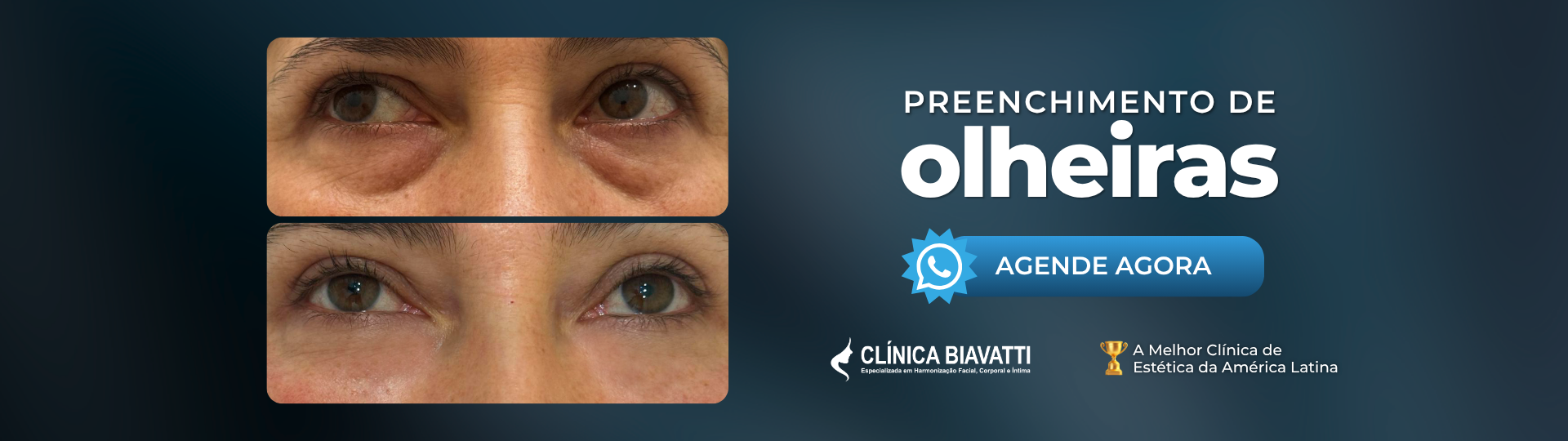 Olheiras