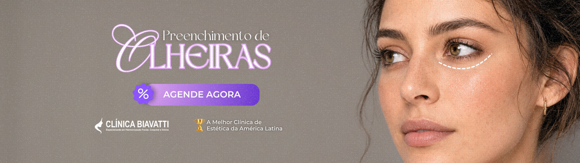 Olheiras - Banner