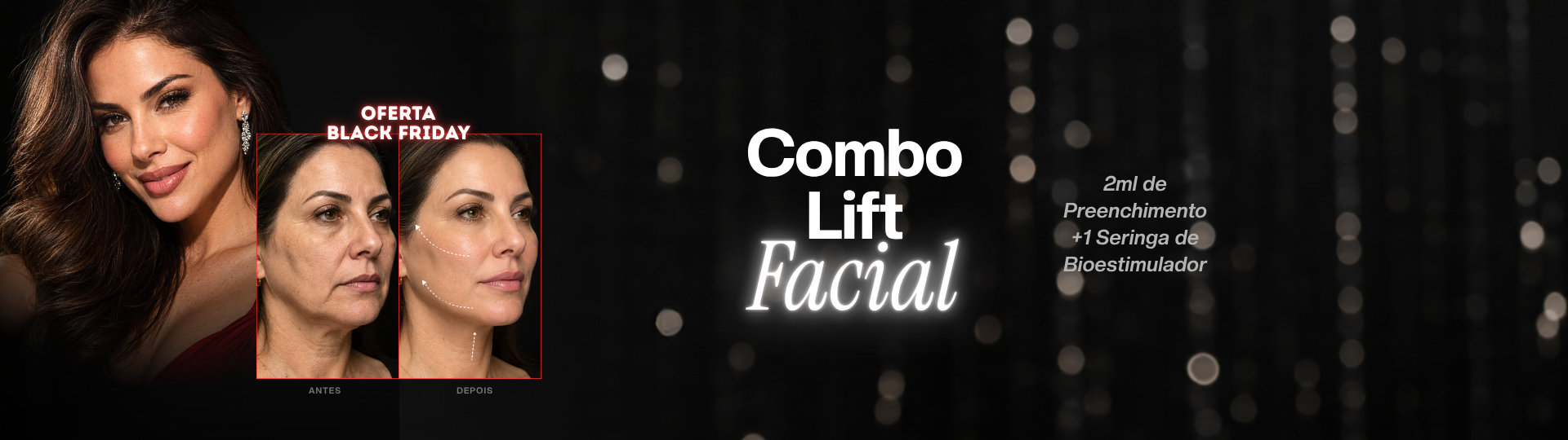 Combo 3