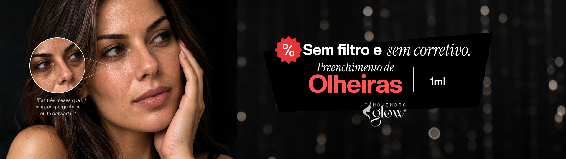 Olheiras
